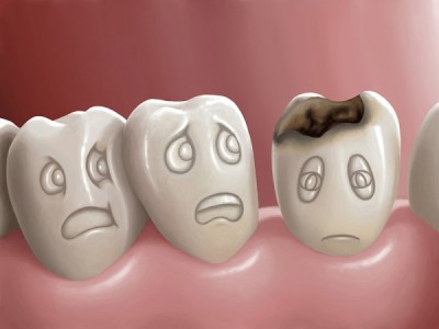 Endodonzia