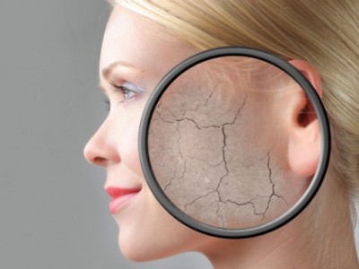 bio-rivitalizzazione cutanea