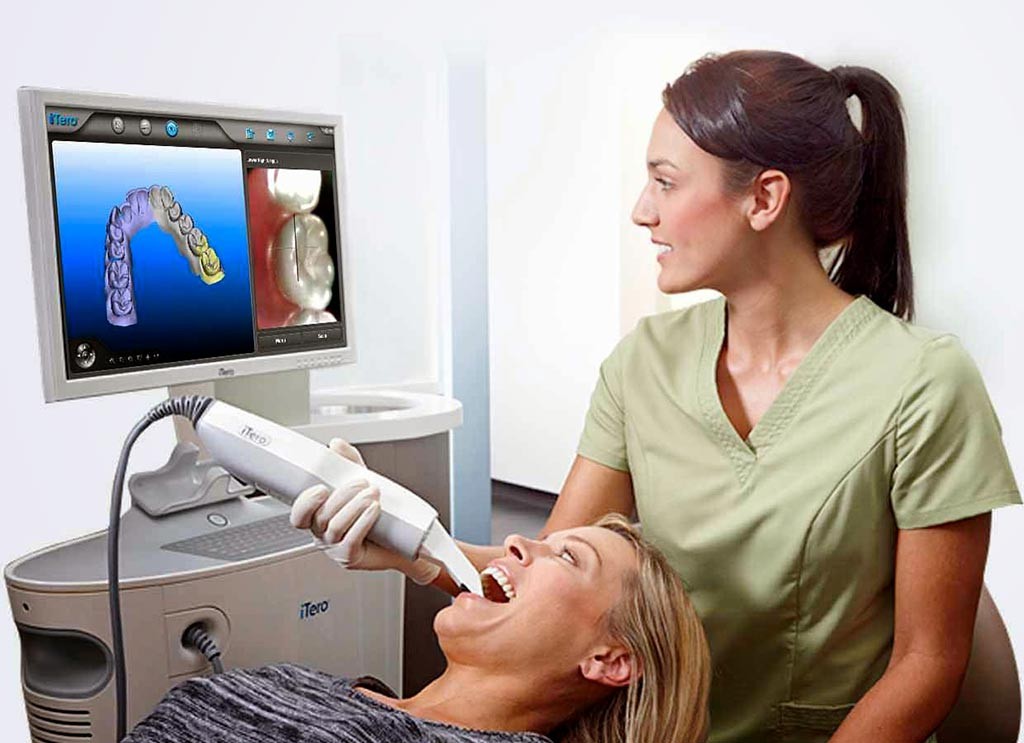 scanner dentale
