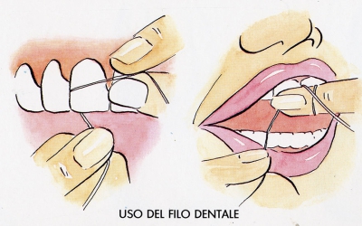 FILO INTERDENTALE