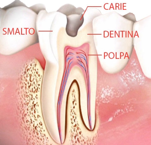 odontoiatria conservativa ed endodonzia